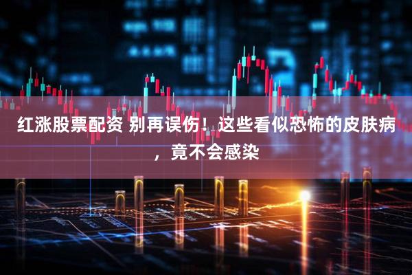 红涨股票配资 别再误伤！这些看似恐怖的皮肤病，竟不会感染